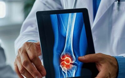 Nearly New Knee, Naturally from LeHeal Biogenix
